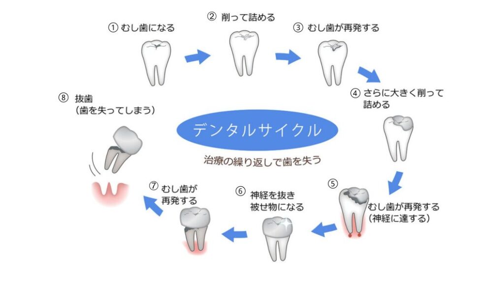 デンタルサイクル