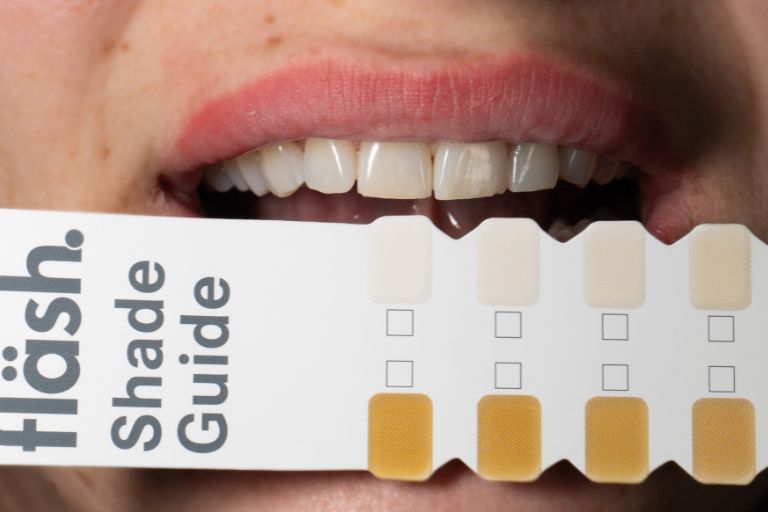 ホワイトニングとは？