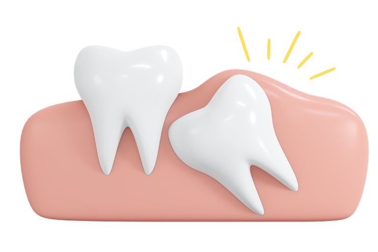 親知らずとは？