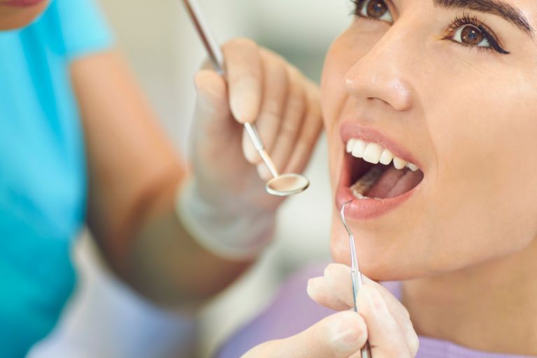 銀歯とセラミックの各メリット・デメリット