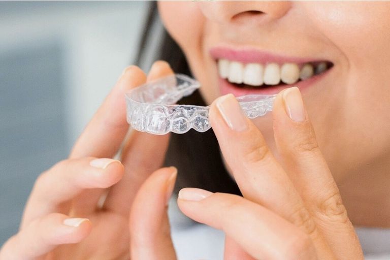 マウスピースの効果とメリット