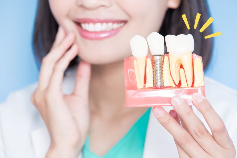そもそも歯科インプラントとは？