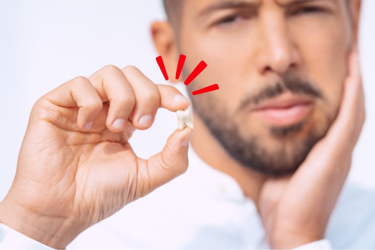 親知らずの抜歯が必要なケース